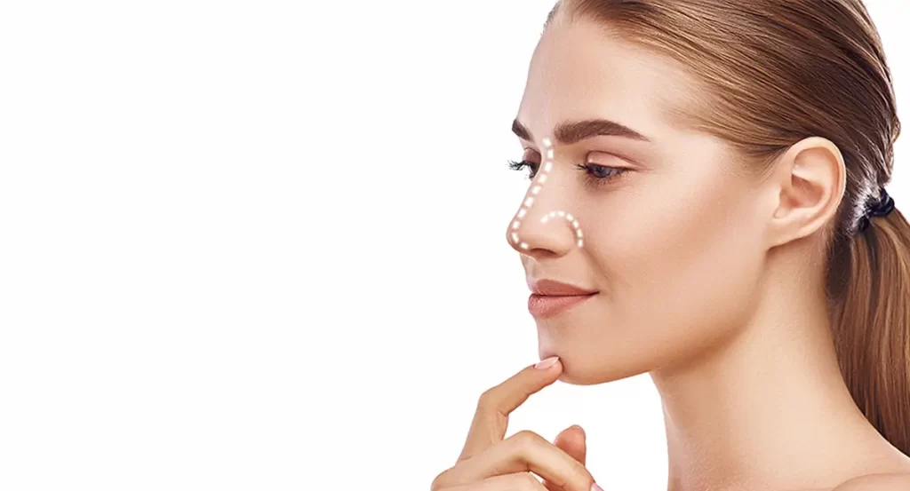 Nose Filler Rhinoplasty