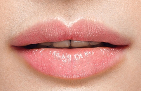 Lip Fillers After Treatment Lip Fillers After Treatment